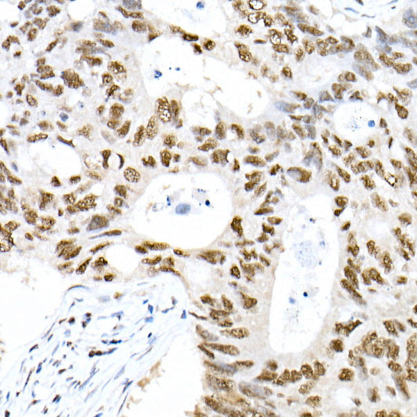 Phospho-Smad3-S423/S425 Rabbit mAb
