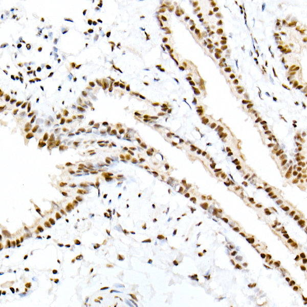 Phospho-Smad3-S423/S425 Rabbit mAb