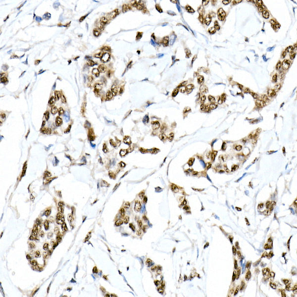 Phospho-Smad3-S423/S425 Rabbit mAb
