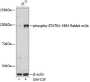 Phospho-STAT5A-Y694 Rabbit mAb