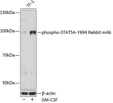 Phospho-STAT5A-Y694 Rabbit mAb