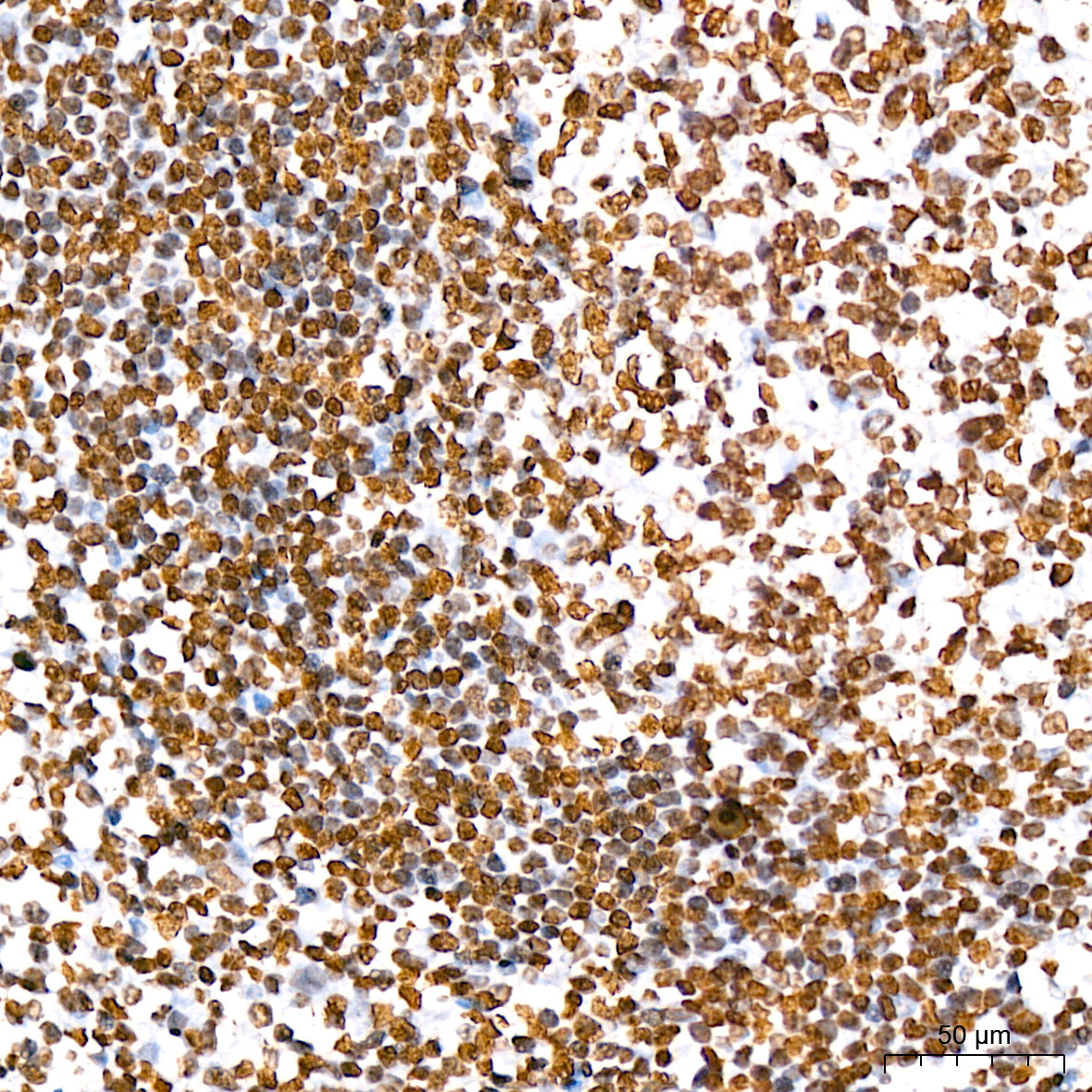 Phospho-STAT5A-Y694 Rabbit mAb