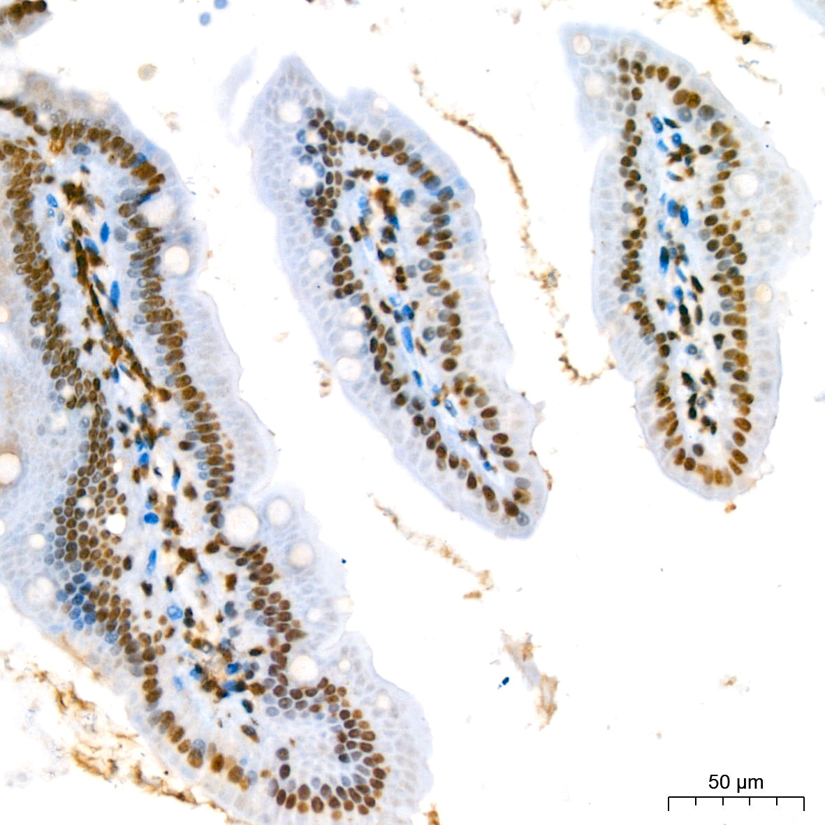Phospho-STAT5A-Y694 Rabbit mAb