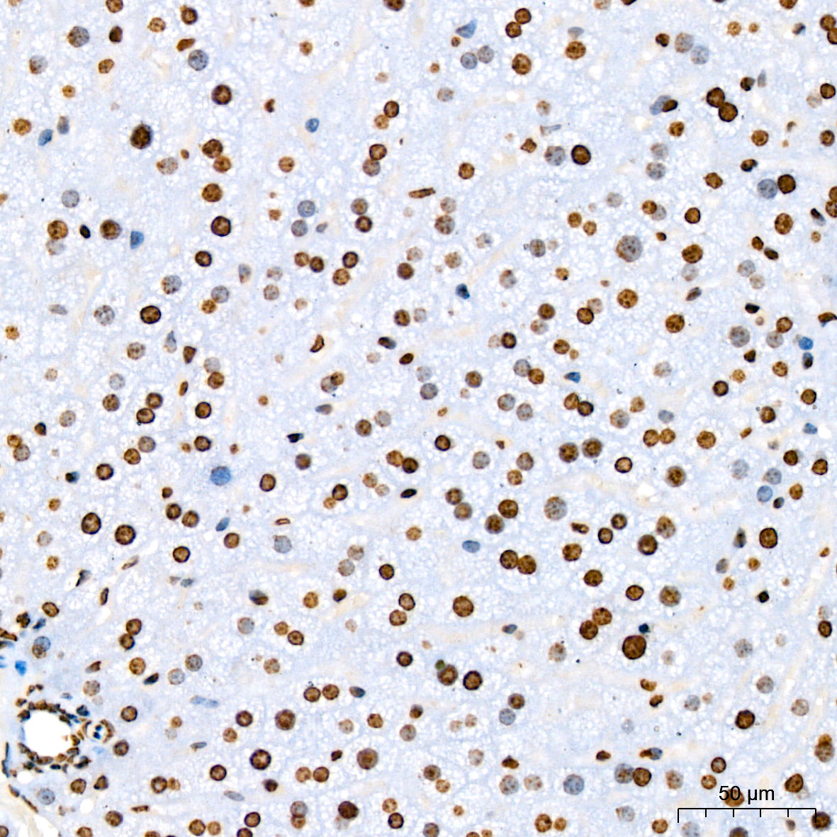 Phospho-STAT5A-Y694 Rabbit mAb
