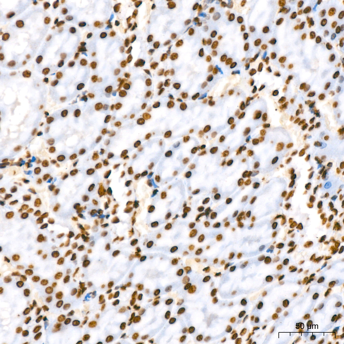 Phospho-STAT5A-Y694 Rabbit mAb