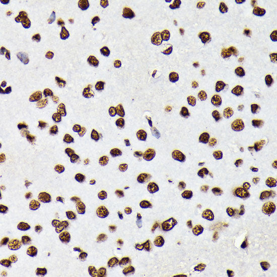 Phospho-STAT5A-Y694 Rabbit mAb