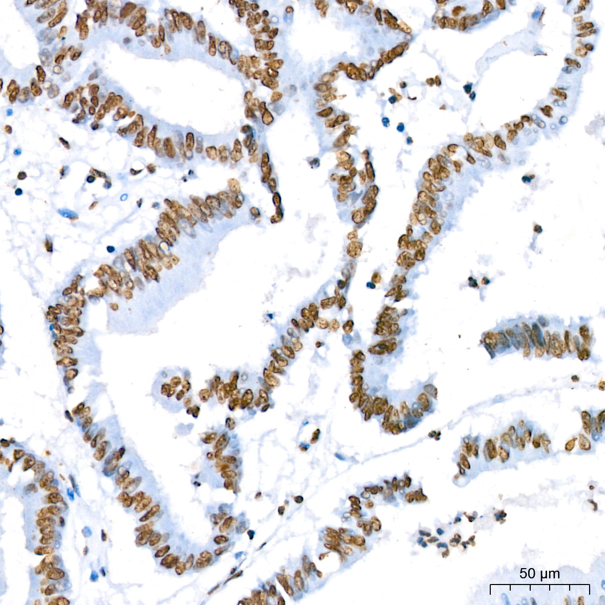 Phospho-STAT5A-Y694 Rabbit mAb