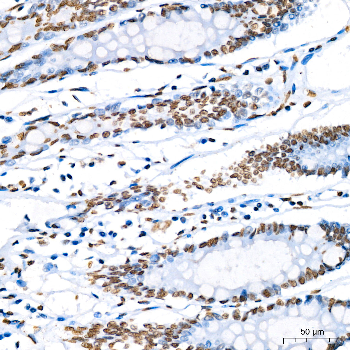 Phospho-STAT5A-Y694 Rabbit mAb