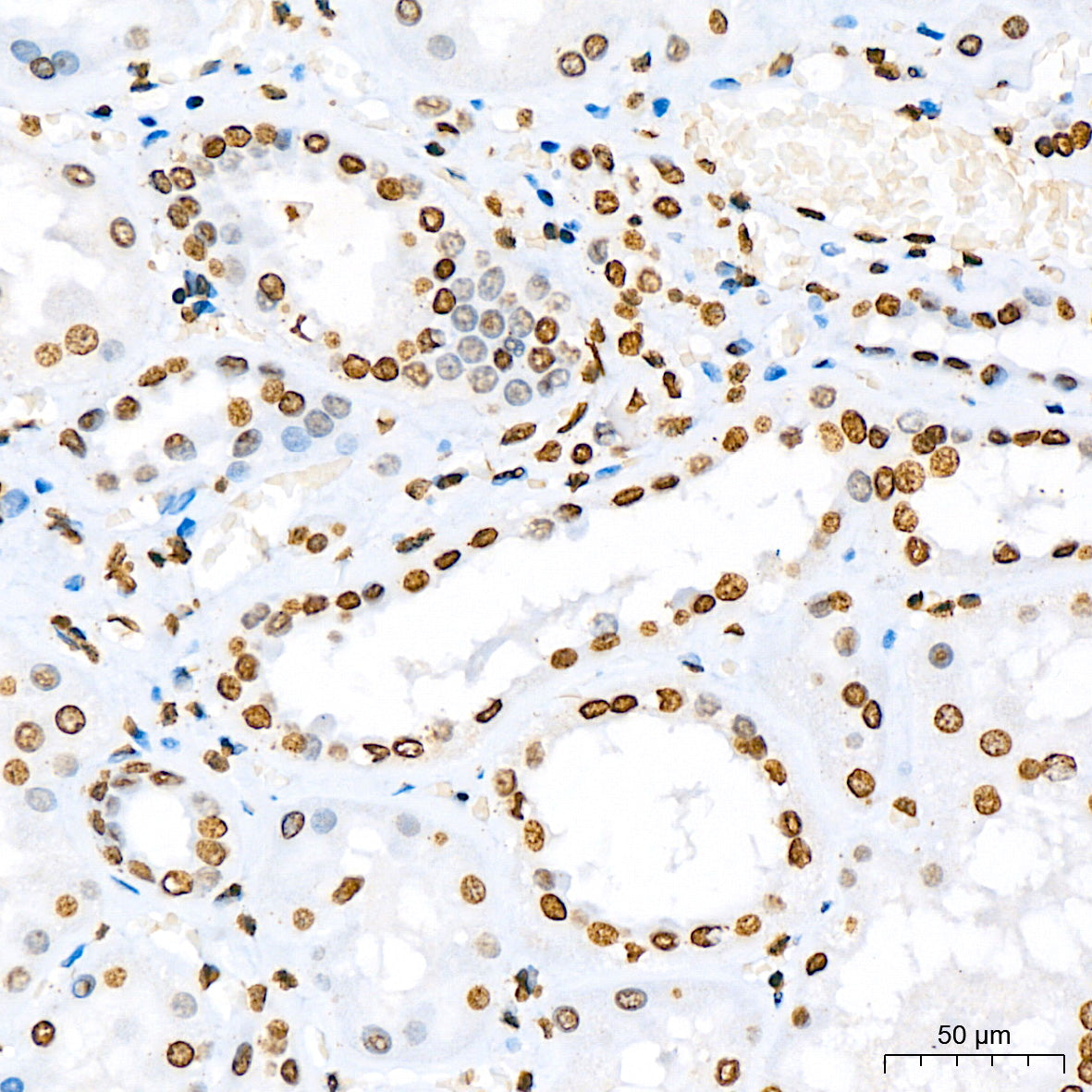 Phospho-STAT5A-Y694 Rabbit mAb