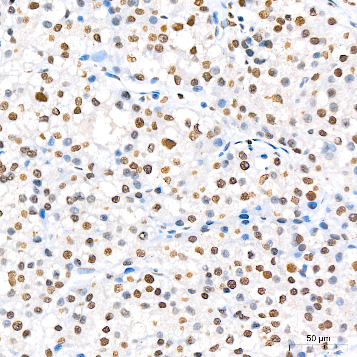 Phospho-STAT5A-Y694 Rabbit mAb