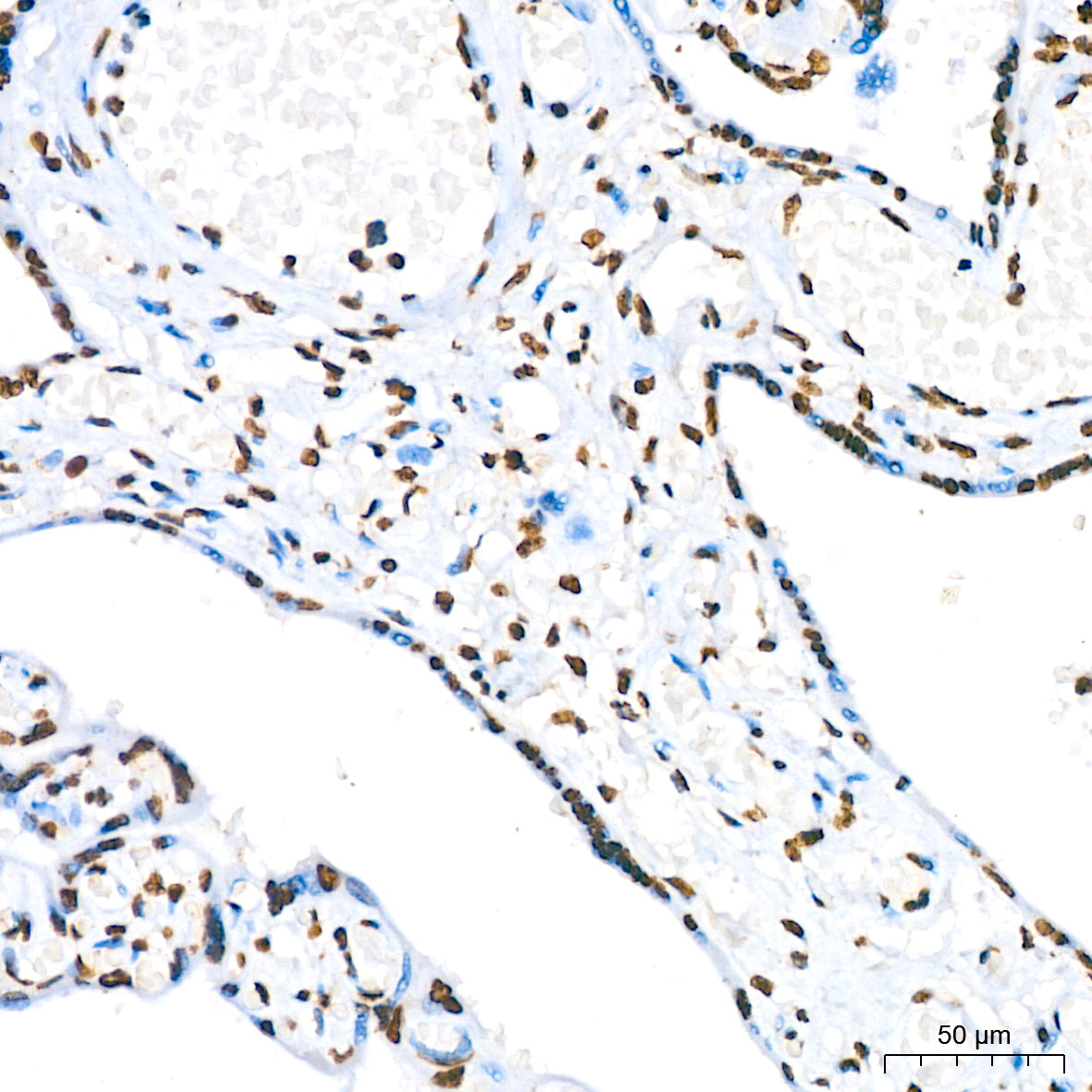 Phospho-STAT5A-Y694 Rabbit mAb