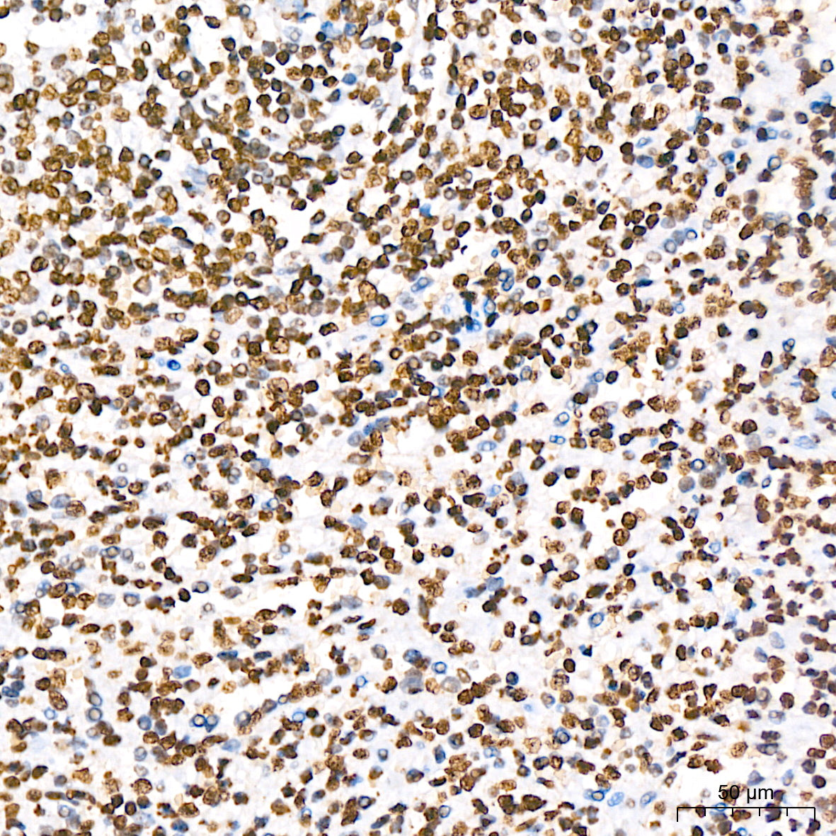 Phospho-STAT5A-Y694 Rabbit mAb