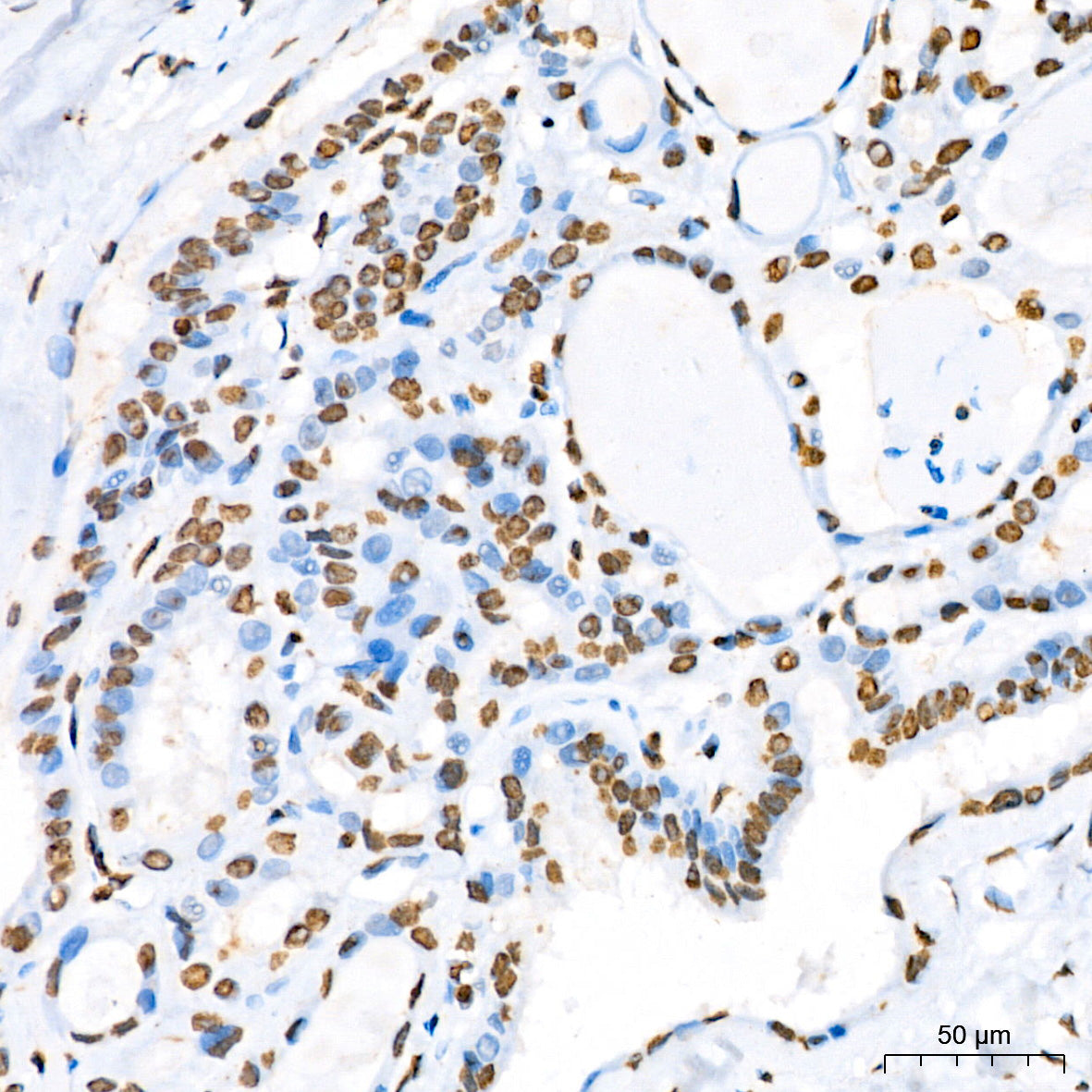 Phospho-STAT5A-Y694 Rabbit mAb