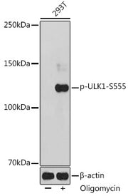 Phospho-ULK1-S555 Rabbit pAb