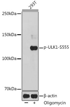 Phospho-ULK1-S555 Rabbit pAb