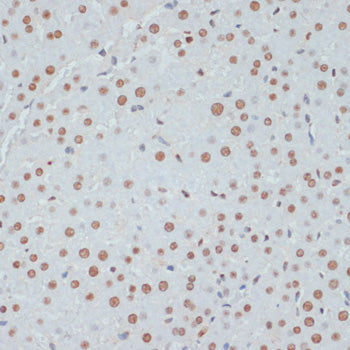 Phospho-p53-S33 Rabbit pAb