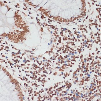 Phospho-p53-S33 Rabbit pAb