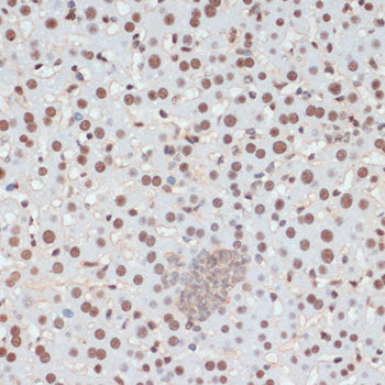 Phospho-p53-S33 Rabbit pAb