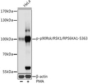 Phospho-p90Rsk/RSK1/RPS6KA1-S363 Rabbit pAb