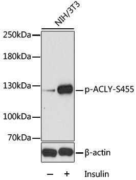 Phospho-ACLY-S455 Rabbit pAb