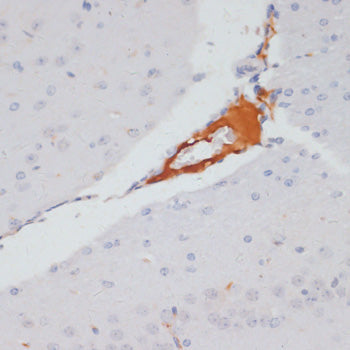 Phospho-ACLY-S455 Rabbit pAb