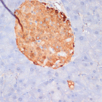 Phospho-ACLY-S455 Rabbit pAb
