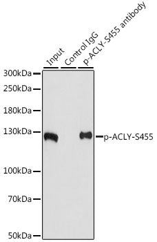 Phospho-ACLY-S455 Rabbit pAb