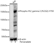 Phospho-PLC gamma 2 (PLCG2)-Y759 Rabbit pAb