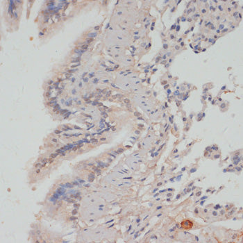 Phospho-PPP1CA-T320 Rabbit pAb