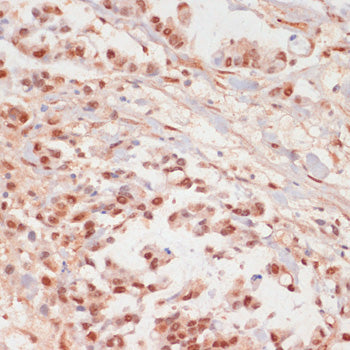 Phospho-PPP1CA-T320 Rabbit pAb