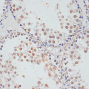 Phospho-RPS6KA5-S376 Rabbit pAb