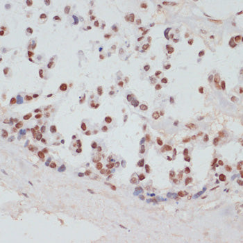 Phospho-RPS6KA5-S376 Rabbit pAb
