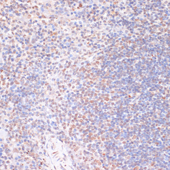 Phospho-RPS6KA5-S376 Rabbit pAb