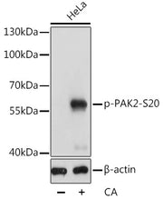 Phospho-PAK2-S20 Rabbit pAb