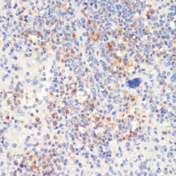 Phospho-PLC gamma 2 (PLCG2)-Y1217 Rabbit pAb