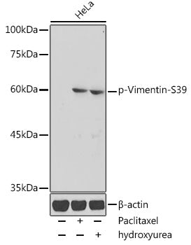 Phospho-Vimentin-S39 Rabbit pAb