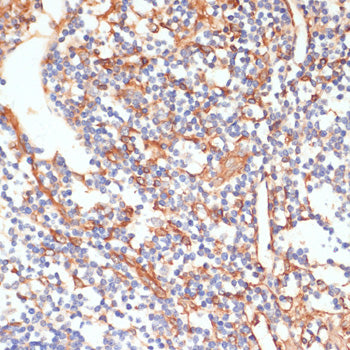 Phospho-Vimentin-S39 Rabbit pAb