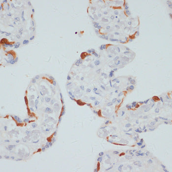 Phospho-PLC gamma 1 (PLCG1)-S1248 Rabbit pAb