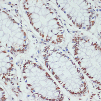 Phospho-POLR2A CTD-S5 Rabbit pAb