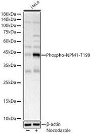 Phospho-NPM1-T199 Rabbit pAb