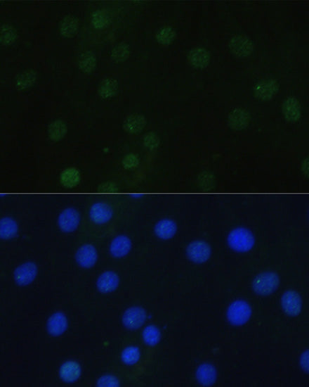 Phospho-Histone H3-S28 Rabbit pAb