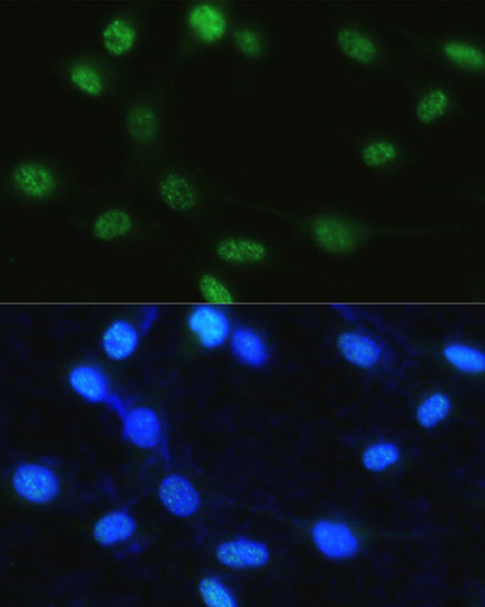 Phospho-Histone H3-S28 Rabbit pAb