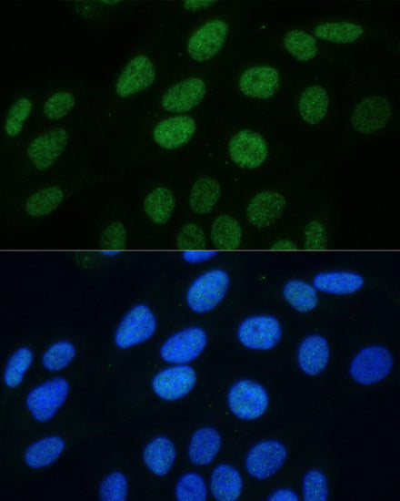 Phospho-Histone H3-S28 Rabbit pAb