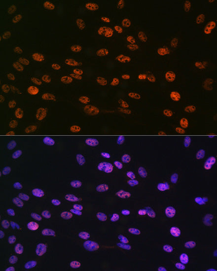 Phospho-Histone H3-S10 Rabbit pAb