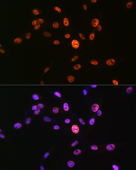 Phospho-Histone H3-S10 Rabbit pAb