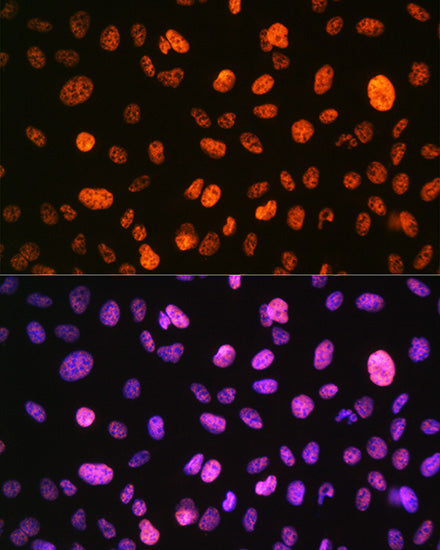 Phospho-Histone H3-S10 Rabbit pAb