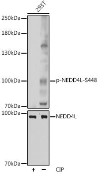 Phospho-NEDD4L-S448 Rabbit pAb