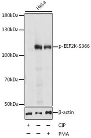 Phospho-EEF2K-S366 Rabbit pAb
