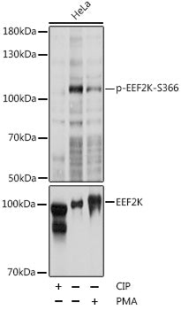Phospho-EEF2K-S366 Rabbit pAb