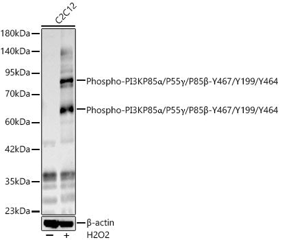 Phospho-PI3KP85α/P55γ/P85β-Y467/Y199/Y464 Rabbit pAb